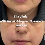 کلینیک زیبایی و لاغری الا بیوتی سنتر