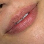 کلینیک زیبایی و لاغری الا بیوتی سنتر