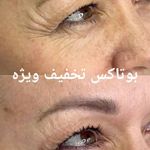 کلینیک زیبایی و لاغری الا بیوتی سنتر