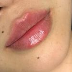 کلینیک زیبایی و لاغری الا بیوتی سنتر