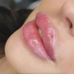 کلینیک زیبایی و لاغری الا بیوتی سنتر