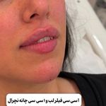 کلینیک زیبایی و لاغری الا بیوتی سنتر