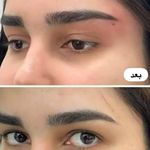 کلینیک زیبایی و لاغری الا بیوتی سنتر