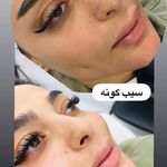 کلینیک زیبایی و لاغری الا بیوتی سنتر