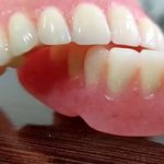 دندانسازی مهرآرا یزد