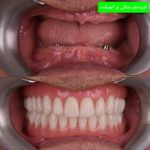 دندانپزشکی مطب دکتر هدیه هدایت زاده