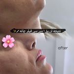 مرکز لیزر و کلینیک زیبایی پریفا