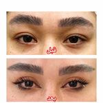 بلفاروپلاستی دکتر سیدمحمدرضا حسینی