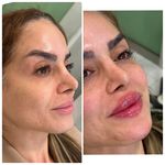 کلینیک زیبایی و لیزر لوتوس