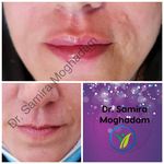 کلینیک پوست و لیزر ژینوس دکتر مقدم