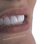 دندانپزشکی دکتر مهدی نعمت الهی