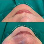 خانه لیزر دیبا