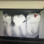 مطب دندانپزشکی دکتر زهره روحی سابق