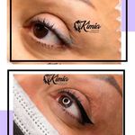 میکروبلیدینگ حرفه ای مریم قلی پور