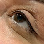 میکروبلیدینگ حرفه ای مریم قلی پور