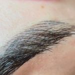 میکروبلیدینگ حرفه ای مریم قلی پور