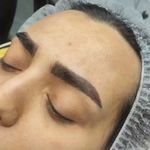 میکروبلیدینگ حرفه ای مریم قلی پور