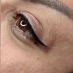 میکروبلیدینگ حرفه ای مریم قلی پور