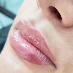 میکروبلیدینگ حرفه ای مریم قلی پور