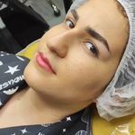 میکروبلیدینگ حرفه ای مریم قلی پور