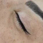 میکروبلیدینگ حرفه ای مریم قلی پور