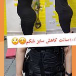 باشگاه لاغری EMS پرنسا(آقایان و بانوان)