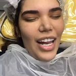 میکروبلیدینگ حرفه ای مریم قلی پور