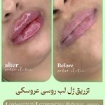 کلینیک لیزر و زیبایی سنسو