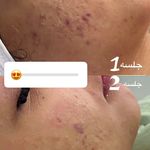 خدمات پاکسازی پوست فیشیال
