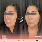 مرکز پزشکی و زیبایی میروژ سنتر