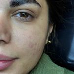 اکستنشن مژه و کاشت زهرا کاظمی