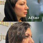 کلینیک زیبایی و لیزر لیانا