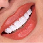 کلینیک دندانپزشکی خاورمیانه نقد و اقساط