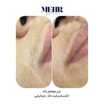 کلینیک زیبایی مهر