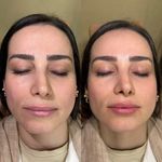 انجام کلیه امور زیبایی تخصصی دکتر بهتاش