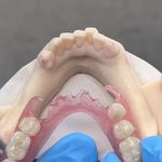 خدمات دندانسازی و اسنپ اسمایل بهشتی