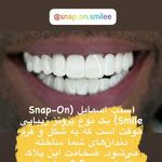 خدمات دندانسازی و اسنپ اسمایل بهشتی