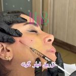 کلینیک پوست،مو، زیبایی و لیزر بارانا