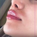 کلینیک پوست،مو، زیبایی و لیزر بارانا