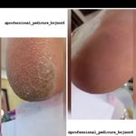 خدمات تخصصی پا، پدیکور و کاشت و ژلیش صدف