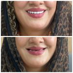 مجموعه دندان پزشکی و دندان سازی نچرال