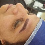 میکرو فیبروز ابرو