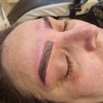 میکرو فیبروز ابرو