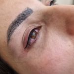 میکرو فیبروز ابرو