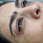 میکرو فیبروز ابرو