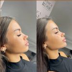 کلینیک پوست و زیبایی ژیلاوَش