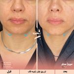 مرکز پزشکی و زیبایی میروژ سنتر