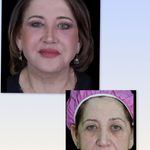 کلینیک زیبایی الماس کاملا اقساطی