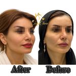 کلینیک پوست و زیبایی ولاغری تاج عظیمیه