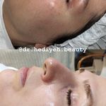 کلینیک زیبایی دکتر هدیه دهقانپور